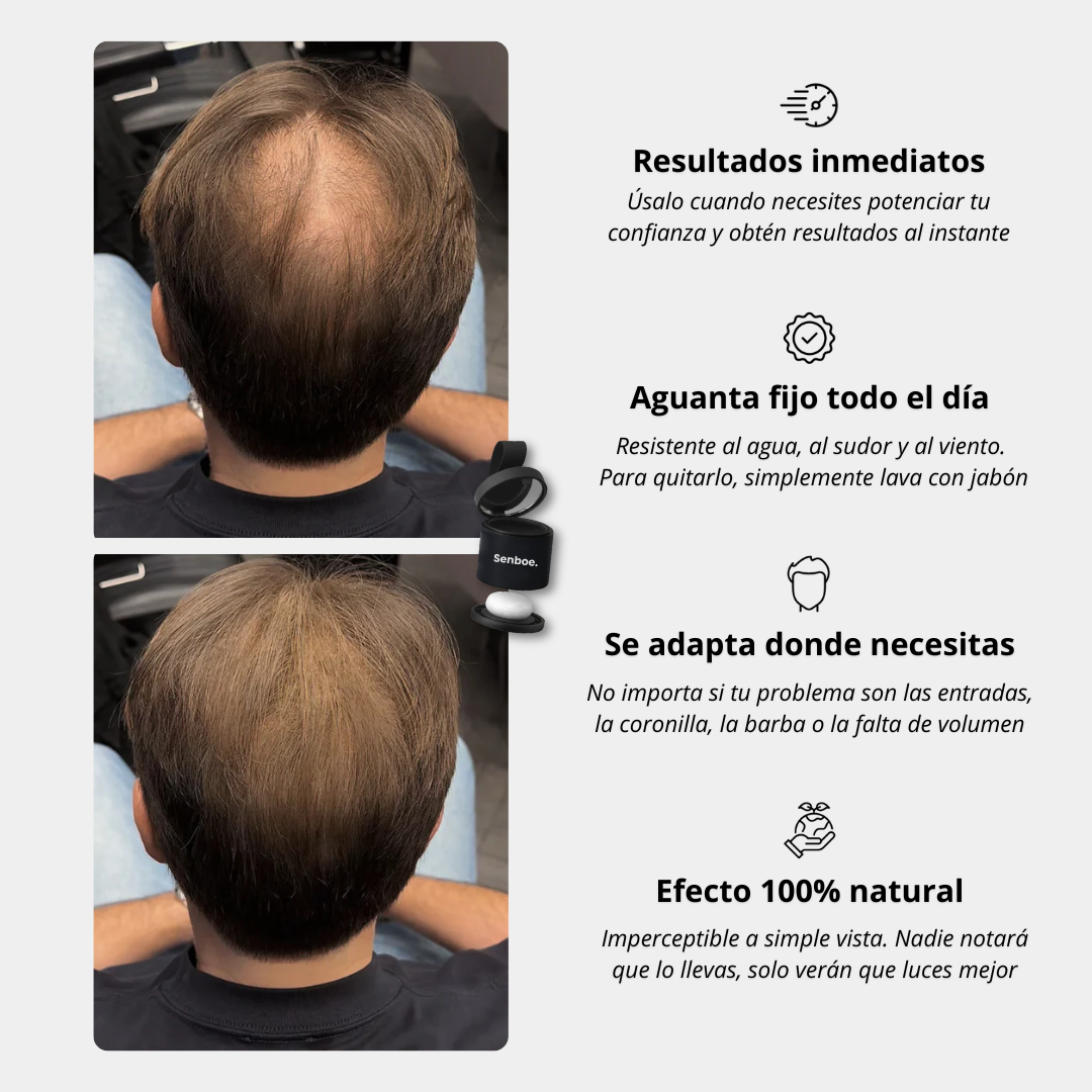 Camuflaje Capilar®