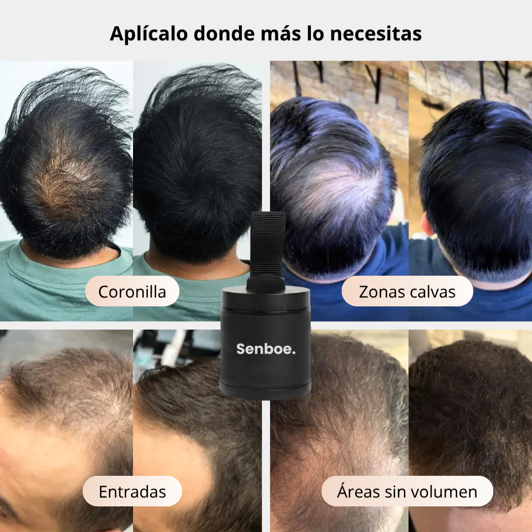 Camuflaje Capilar®
